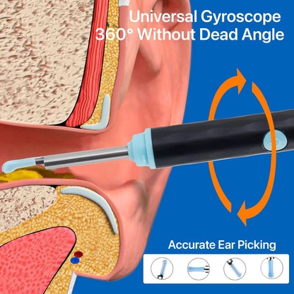 Ear Removal Kit