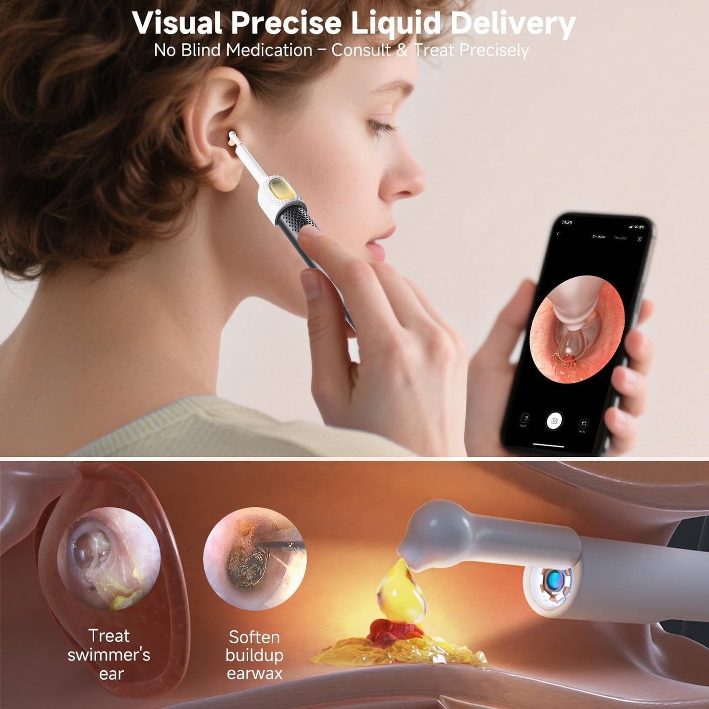Ear Removal Kit